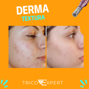 PM Derma (1080 x 1080 px) (2)